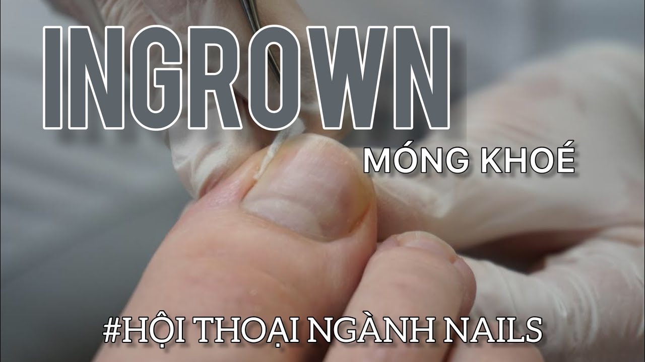 Tư vấn về MÓNG KHÓE----Tiếng Anh ngành Nails