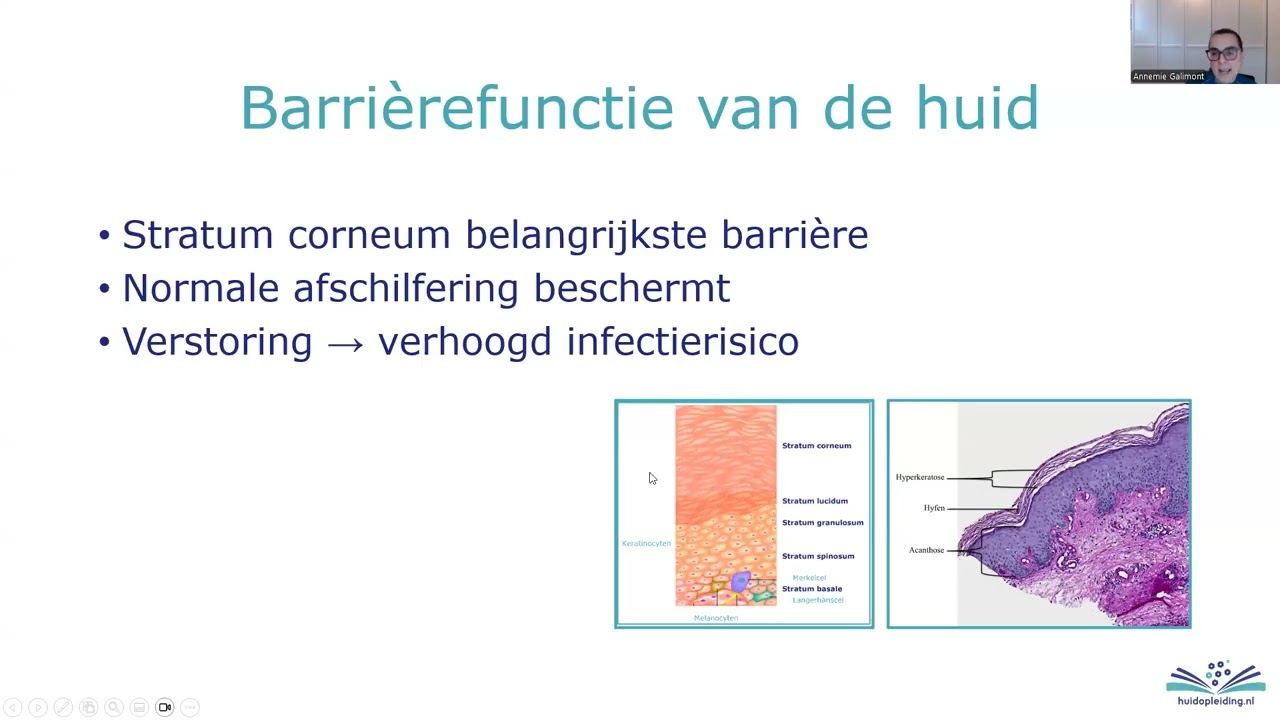 Webinar schimmelinfecties