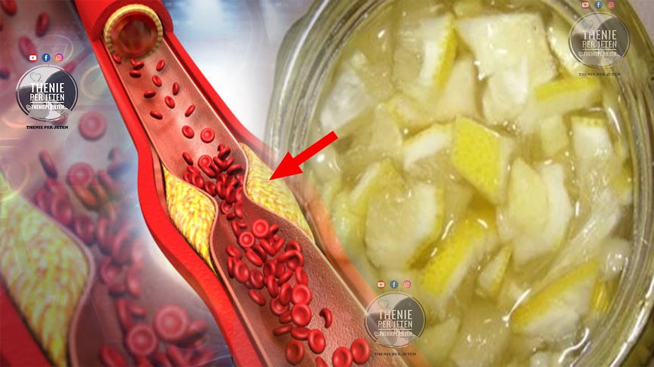 Mbajeni shenim para se te fshihet: Receta qe kuron kolesterolin dhe i'u mbron nga infeksionet