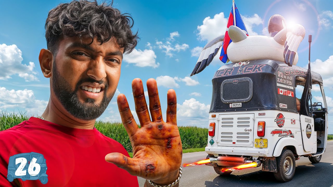 I Burned My Hand… It Hurt Bad 😭 | EP 26