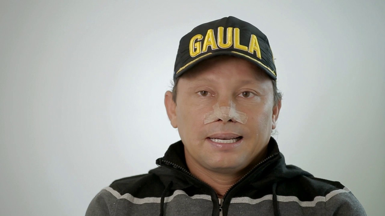 Trasplante Capilar Giovanny Ayala - Episodio 1