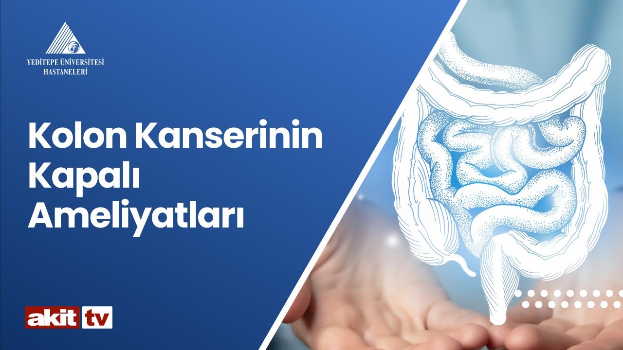 Kolon Kanserinin Kapalı Ameliyatları