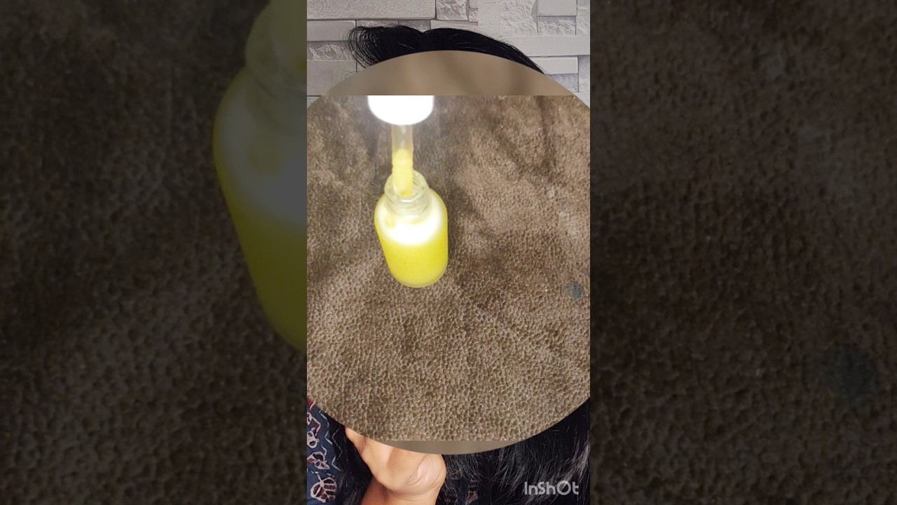 Magical Skin Whitening Face Serum | Get Glowing Skin Fast! #shorts #skinglow #ytff