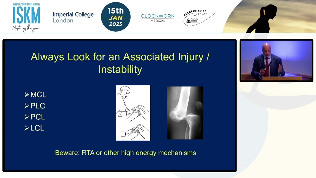 Assessment of a Failed ACL Reconstruction | Prof. Fares Haddad