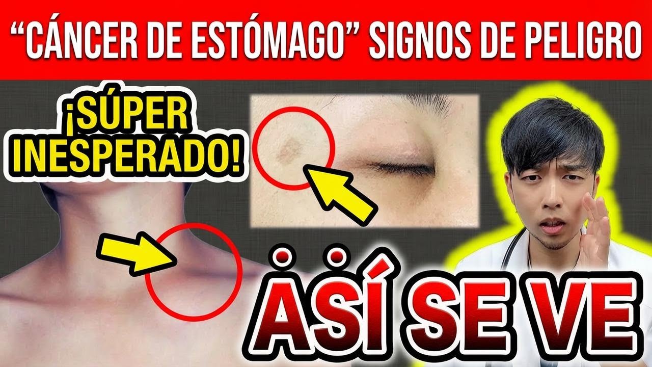 Cambios en tu piel que podrían ser señales de cáncer de estómago: 5 síntomas que no debes ignorar