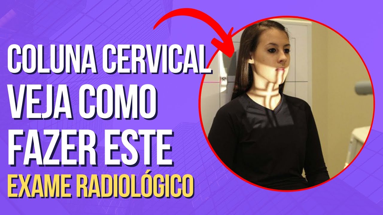Posicionamento radiológico da coluna cervical