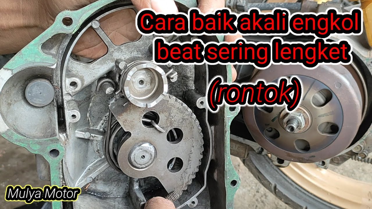 Gigi engkol beat sering lengket dan rontok. Coba lakuka cara ini.