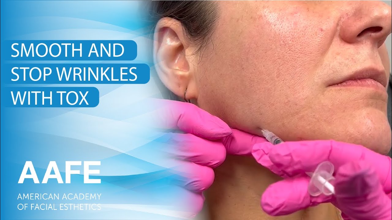 Smooth and Stop Wrinkles with Tox