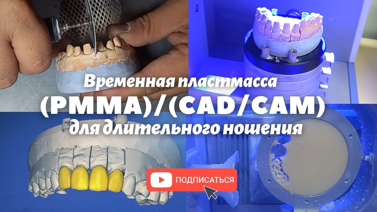 Временная пластмасса PMMA |CAD/CAM| для длительного ношения #PMMA #ЗубнойТехник
