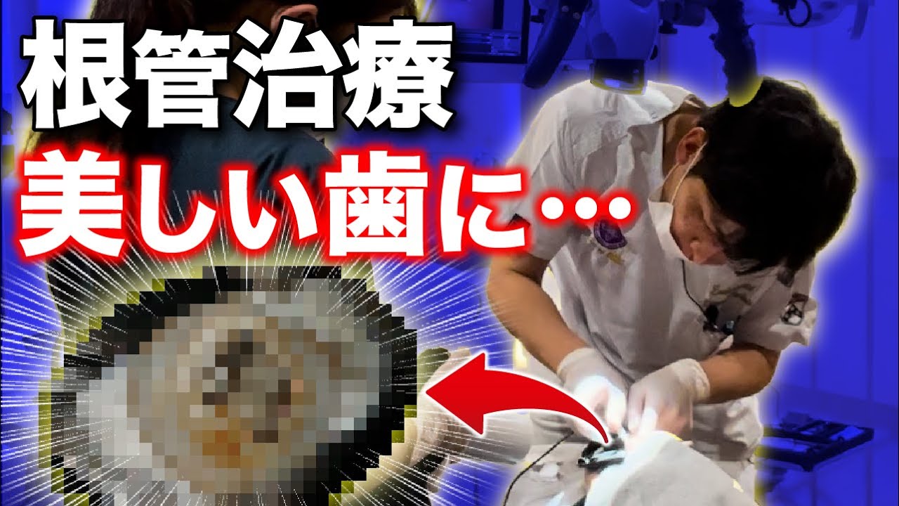 【根管治療②】歯ぐきが腫れた歯の神経治療風景を全部見せます！
