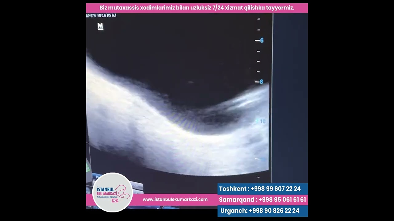 Navbatdagi muvaffaqiyatli transferimiz!