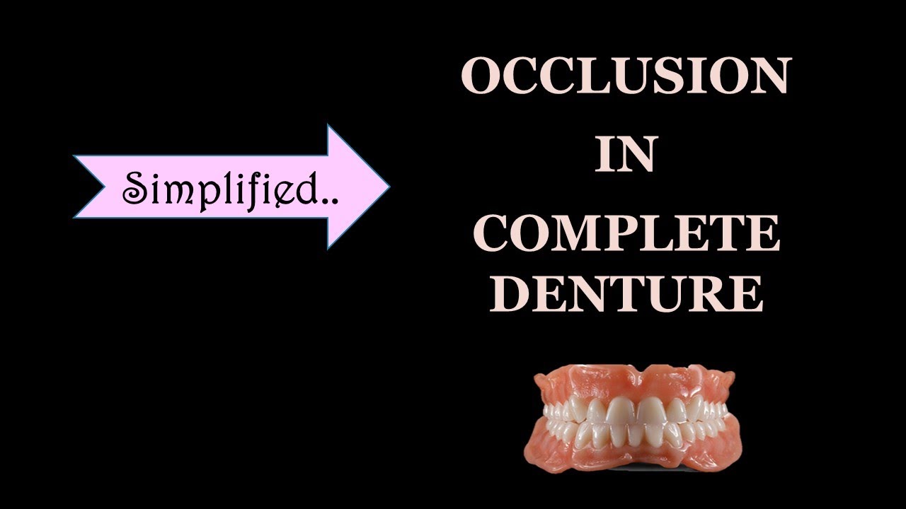 Окклюзия в полном съемном протезе / сбалансированная окклюзия