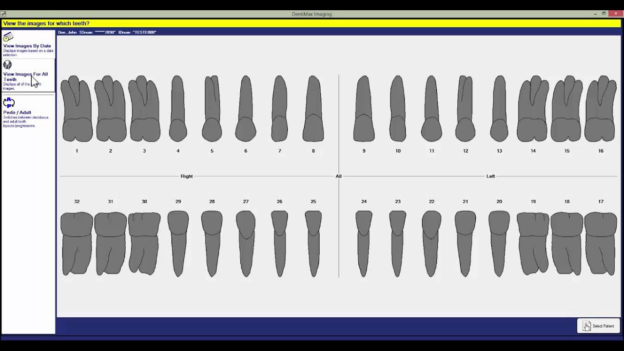 How to Export X-rays | DentiMax Dental Imaging Software Tip