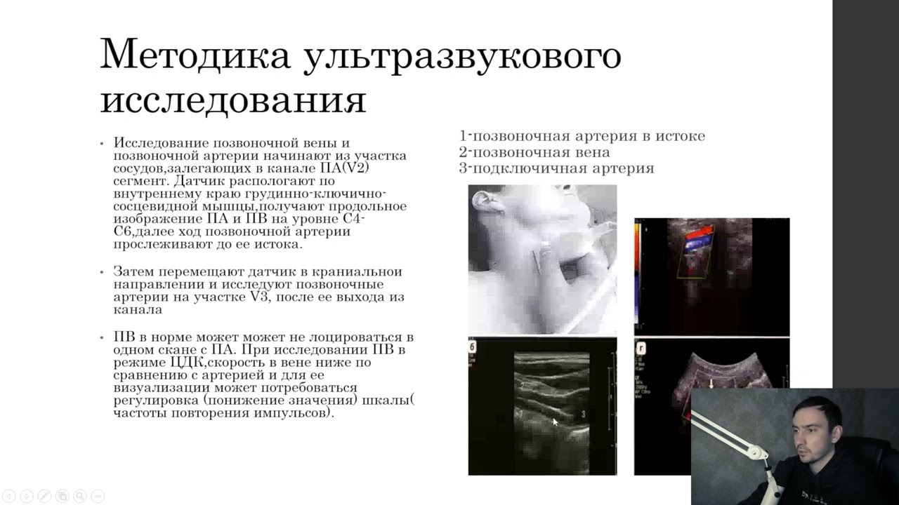 Ультразвуковая диагностика экстракраниальных сосудов(БЦА)