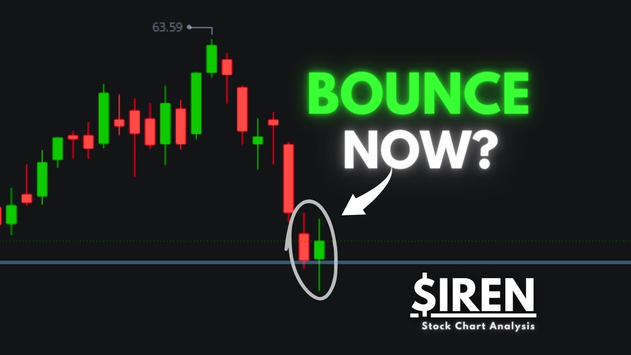 IREN Stock Forecast | Buy The Dip? | Technical Analysis