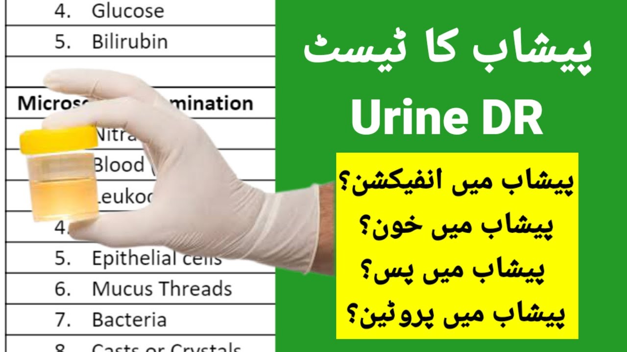 Urine Test in Hindi/Urdu | Understand Urine Analysis Report | How to Read Urinalysis Result
