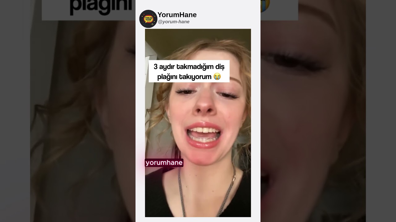 Komik İnstagram Videoları | Diş plağı takma hissi nasıl mı... #komedi #komik #mizah #youtubeshorts