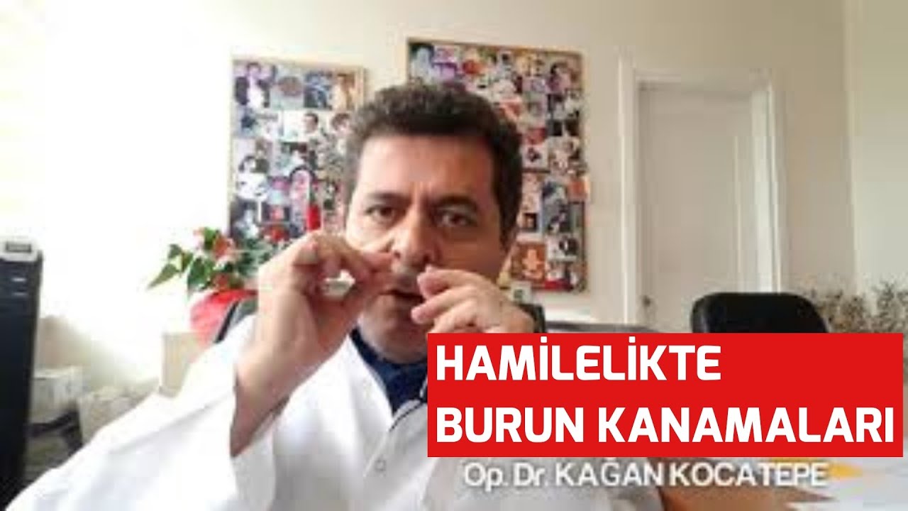 GEBELİKTE BURUN KANAMASI NEDEN OLUR, RİSKLİ MİDİR? NASIL TEDAVİ EDİLİR?( BURUNDA LITTLE BÖLGESİ)