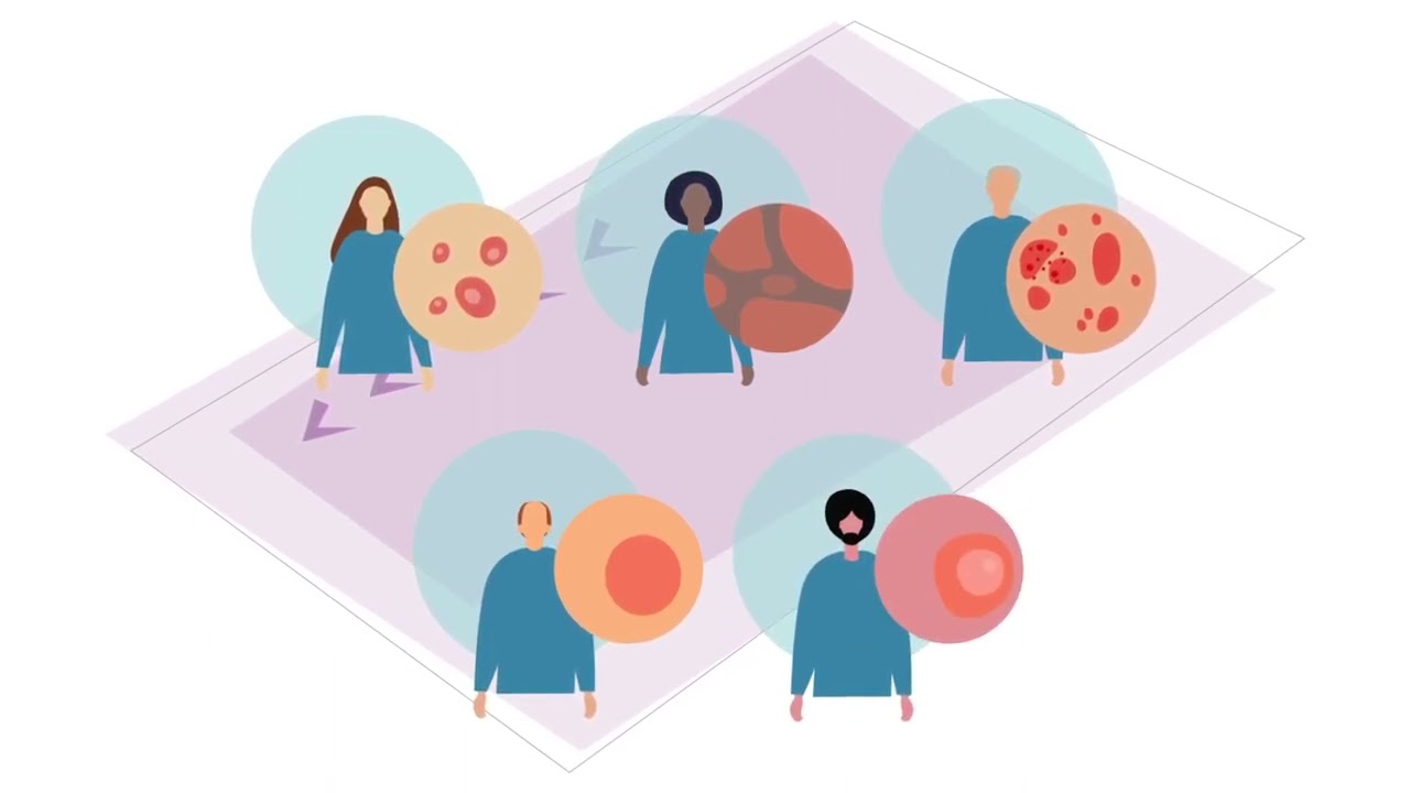 Comprendre la Lymphome cutané à cellules (CTCL)