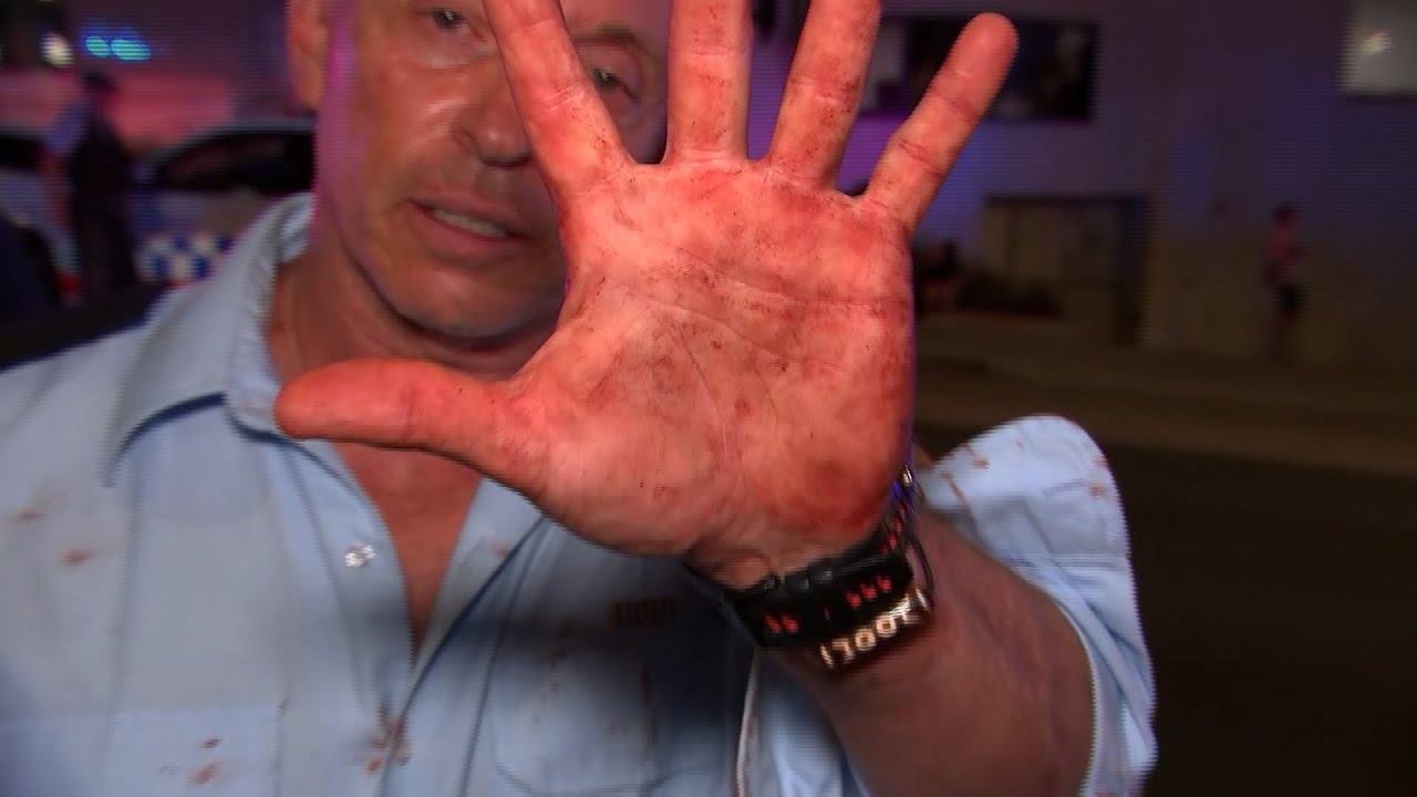 ‘See my hands’: Man tries to resuscitate Bondi Beach shooting victims