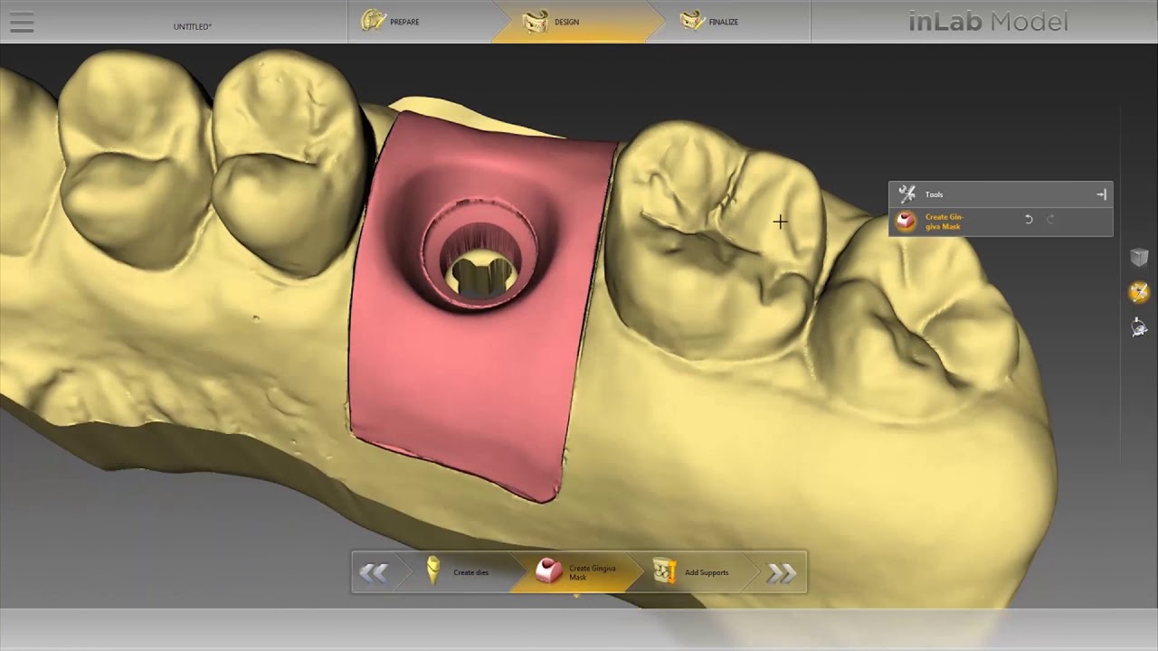 Model Builder App - inLab SW - Dentsply Sirona