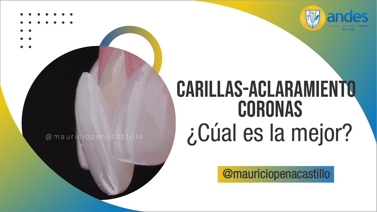 CARILLAS, ACLARAMIENTO, CORONAS ¿Cómo Saber Cuál es la Mejor Opción? + Resolviendo Dudas.