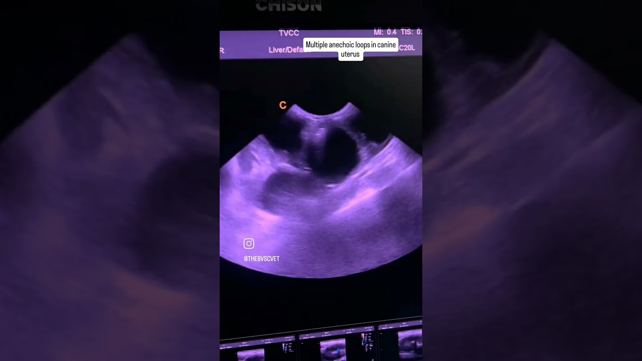 Ultrasound imaging of pyometra in canine:A distended, fluid-filled uterus,consistent with pyometra