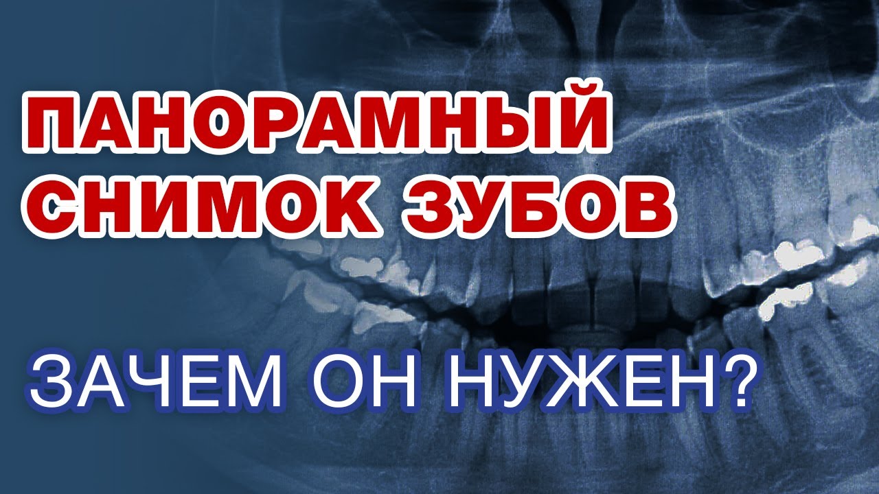 Зачем нужен панорамный снимок зубов? / Виды снимков зубов