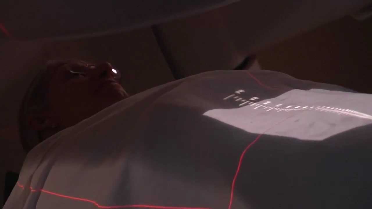 Pinpoint Radiation: SBRT