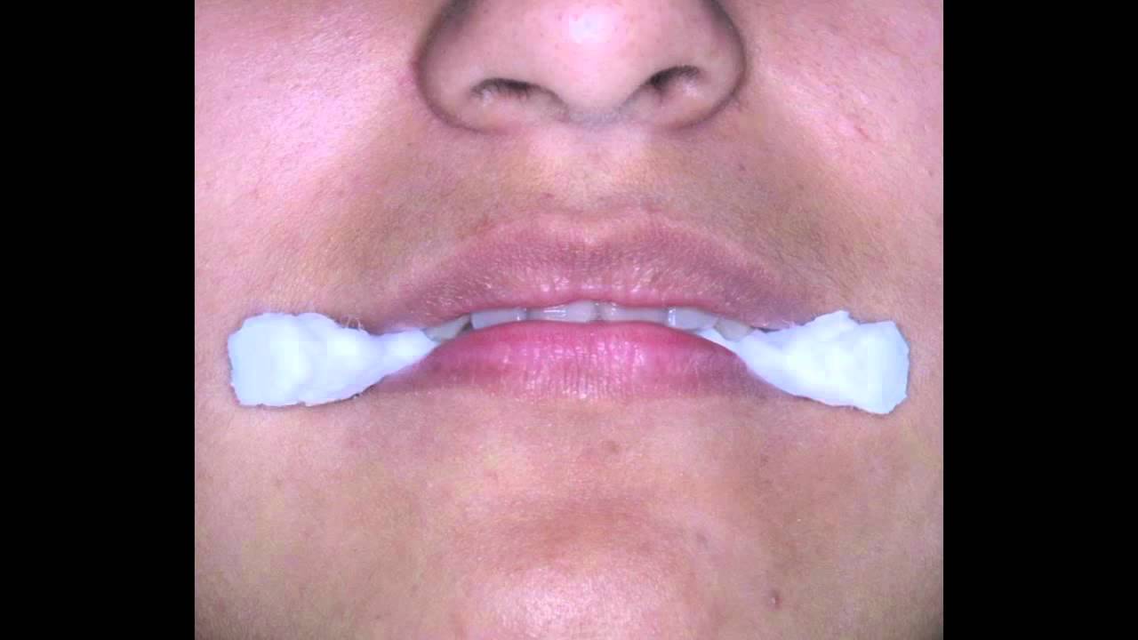 Dr. Mario Romero (DentalSynergy) - Curso online 3. Relación Céntrica e Interferencias Oclusales.