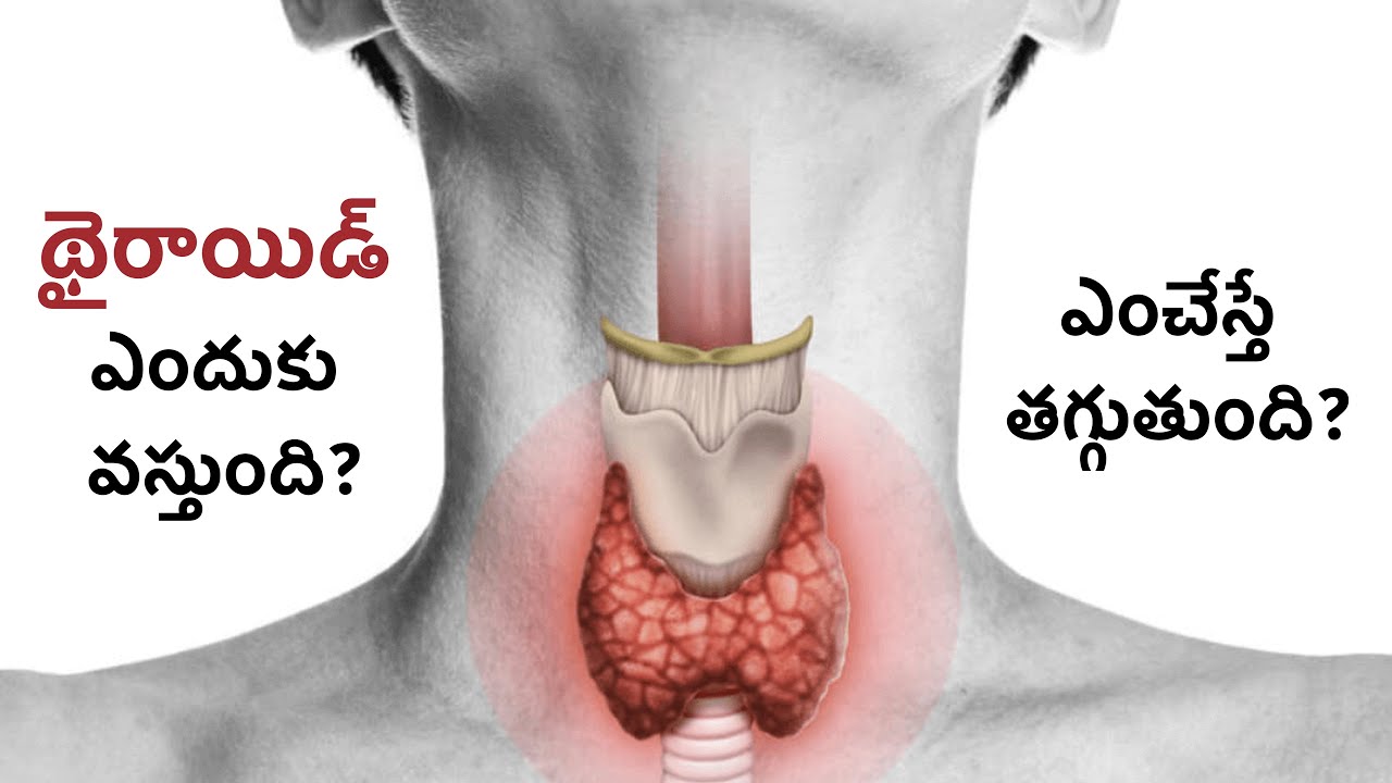 Salt cause Thyroid Problem?! Natural Treatment for Thyroid Problem