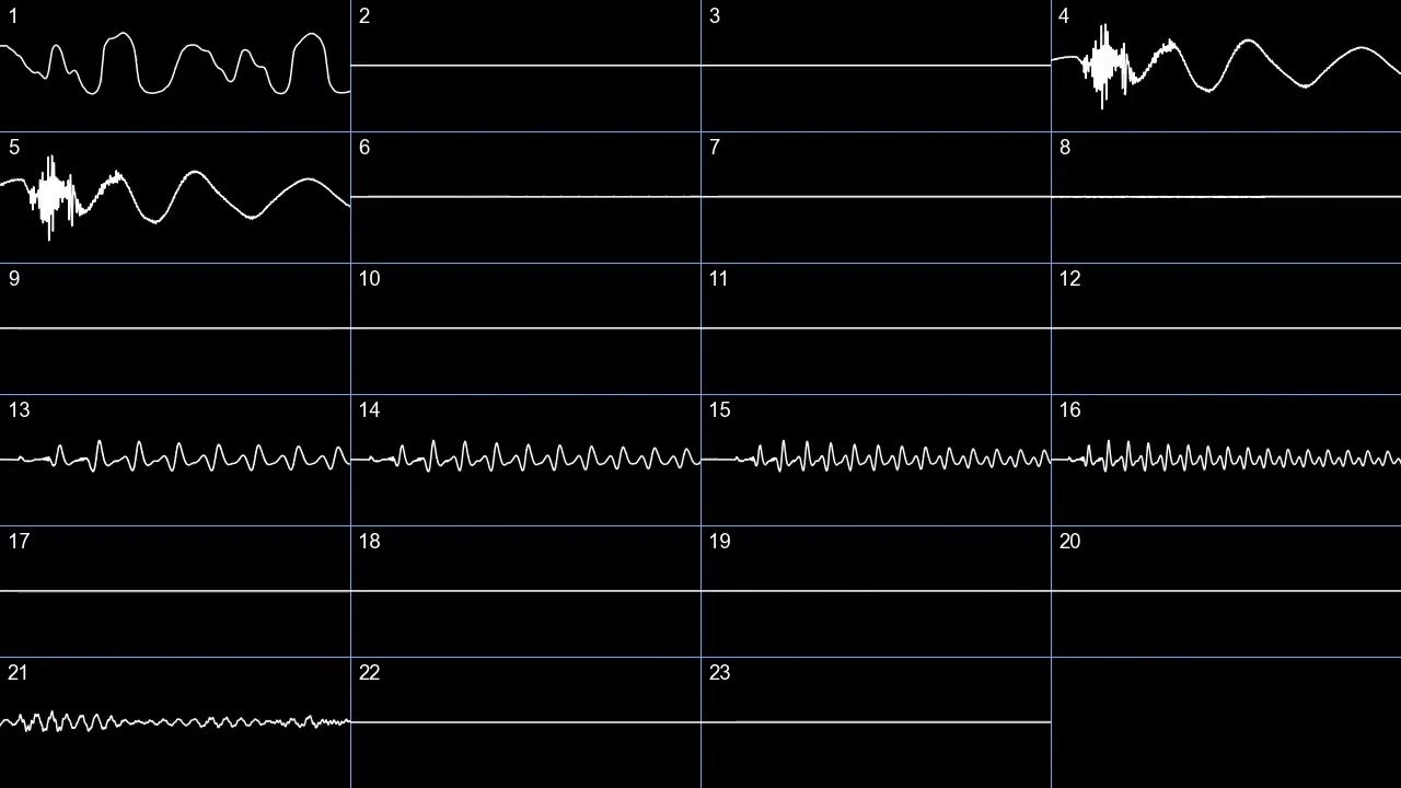 kleeder & mirageofher - Dance with the Restless Dead (oscilloscope)