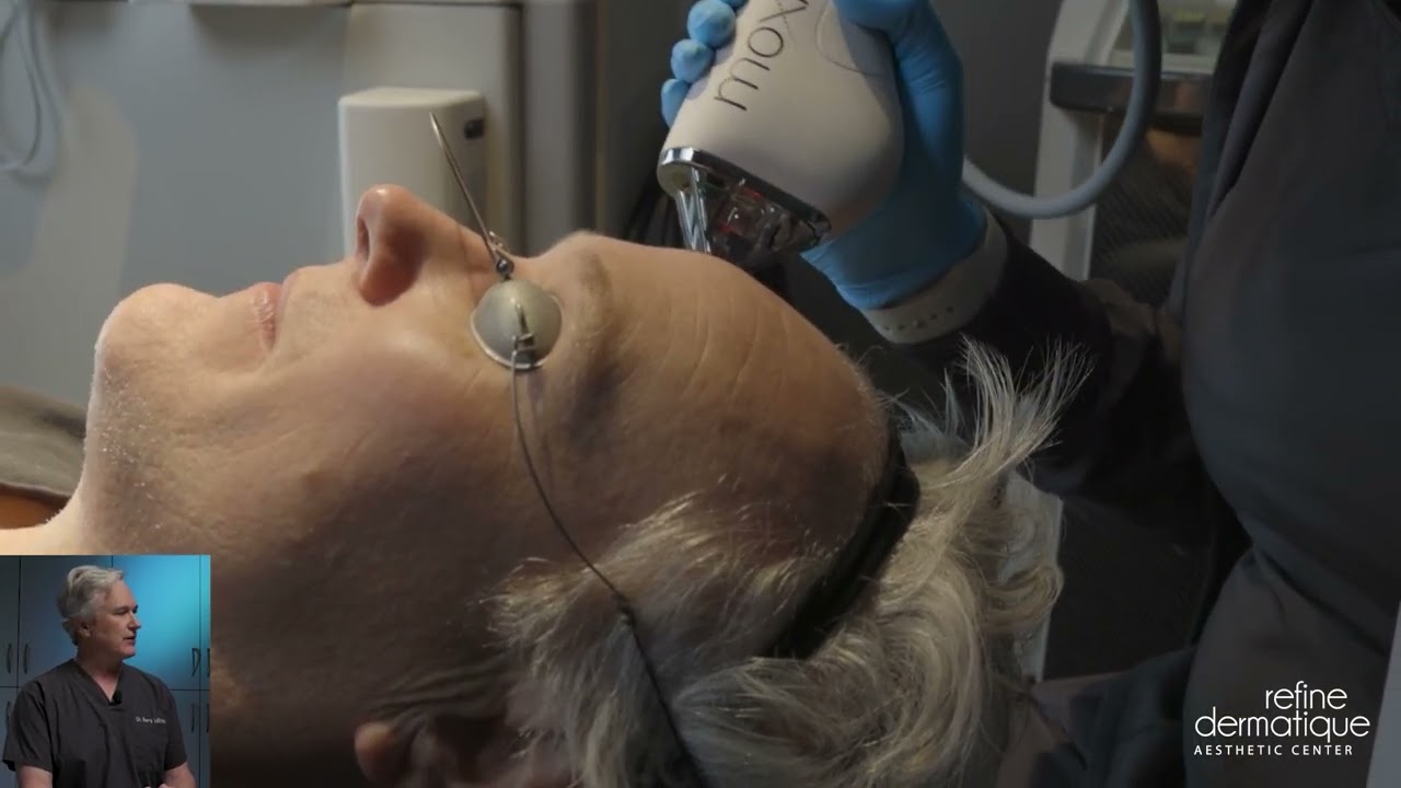 What is the Sciton Moxi treatment?
