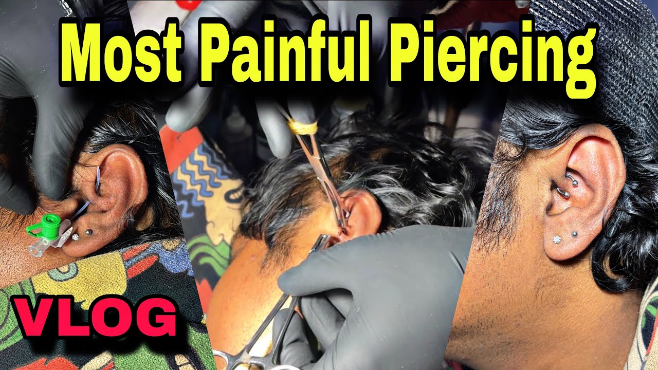 Most Painful Moment || बहुत दर्द हुआ 😨 ||  #vlog #subscribe 