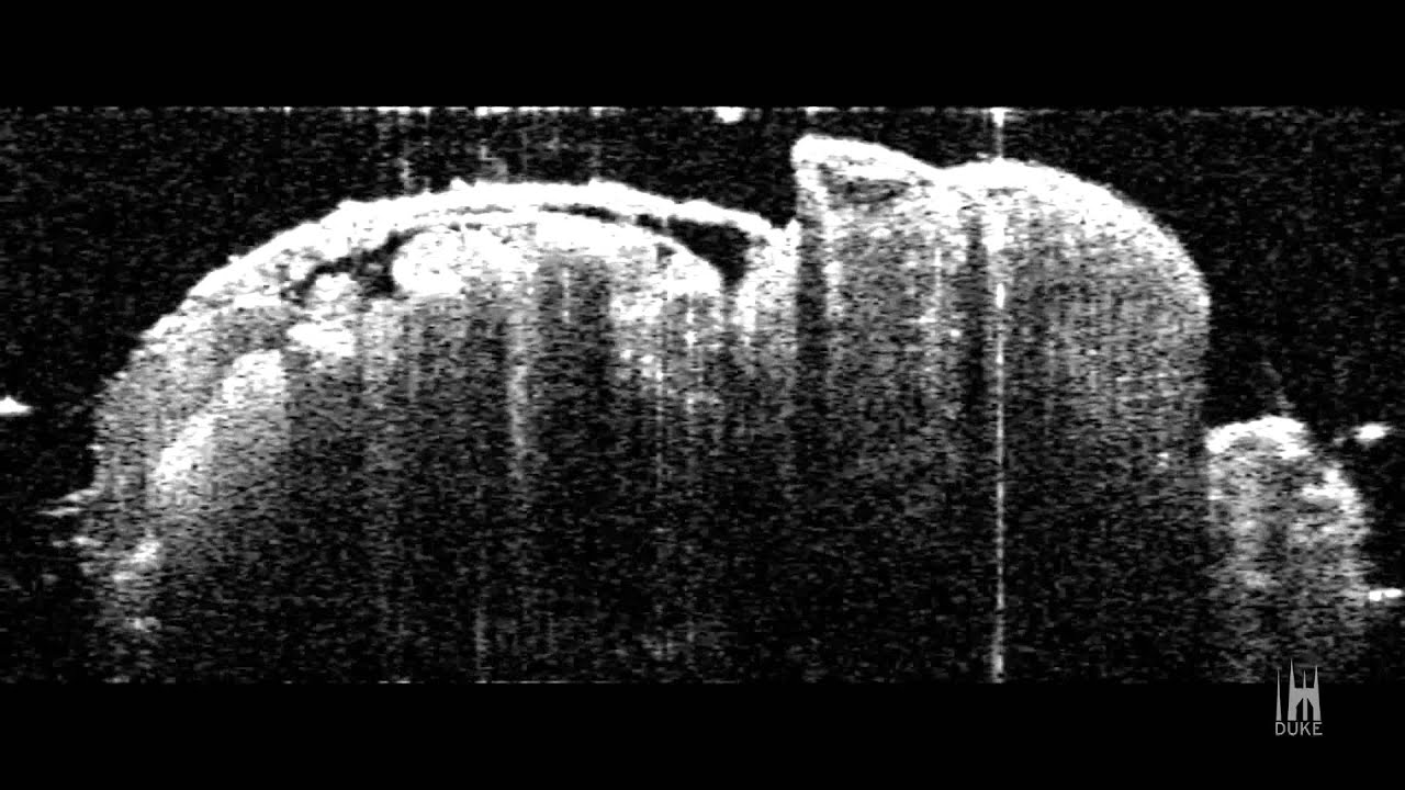 Beating Heart of a Fruit Fly {Duke University Research}