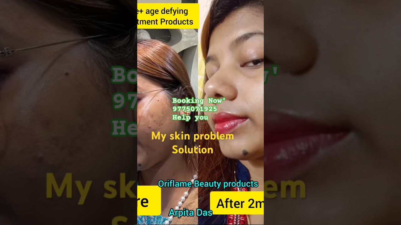 Oriflame opt skin treatments products use kore change my  skin #review #skincare booking 9775071925