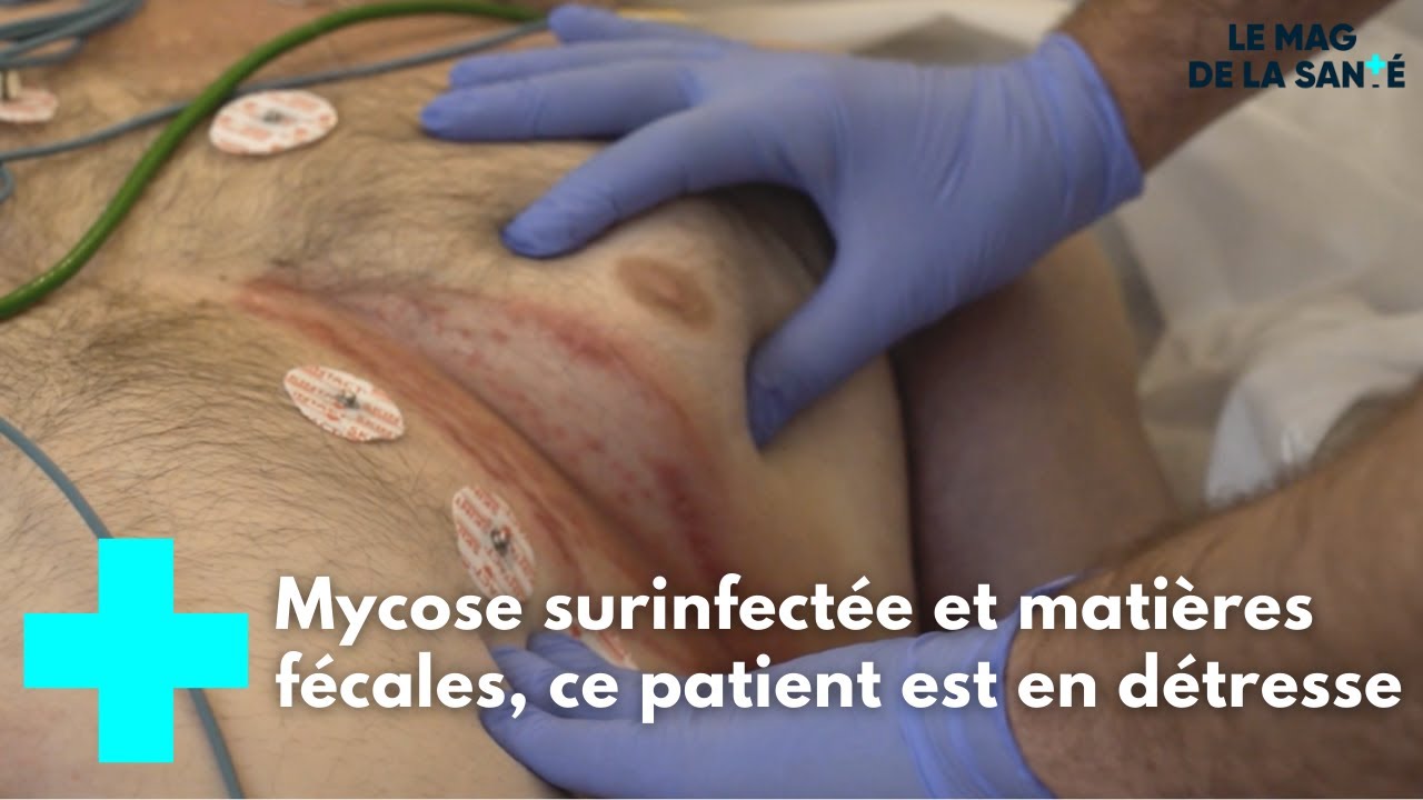 Villeneuve-Saint-Georges : au cœur des urgences 4/5 - Le Magazine de la Santé