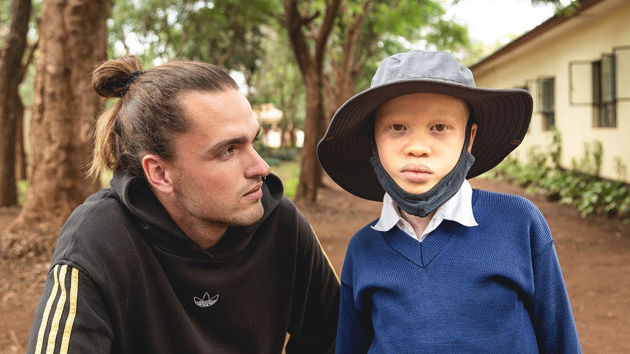 Albinos na África em grave perigo vivem em uma aldeia secreta