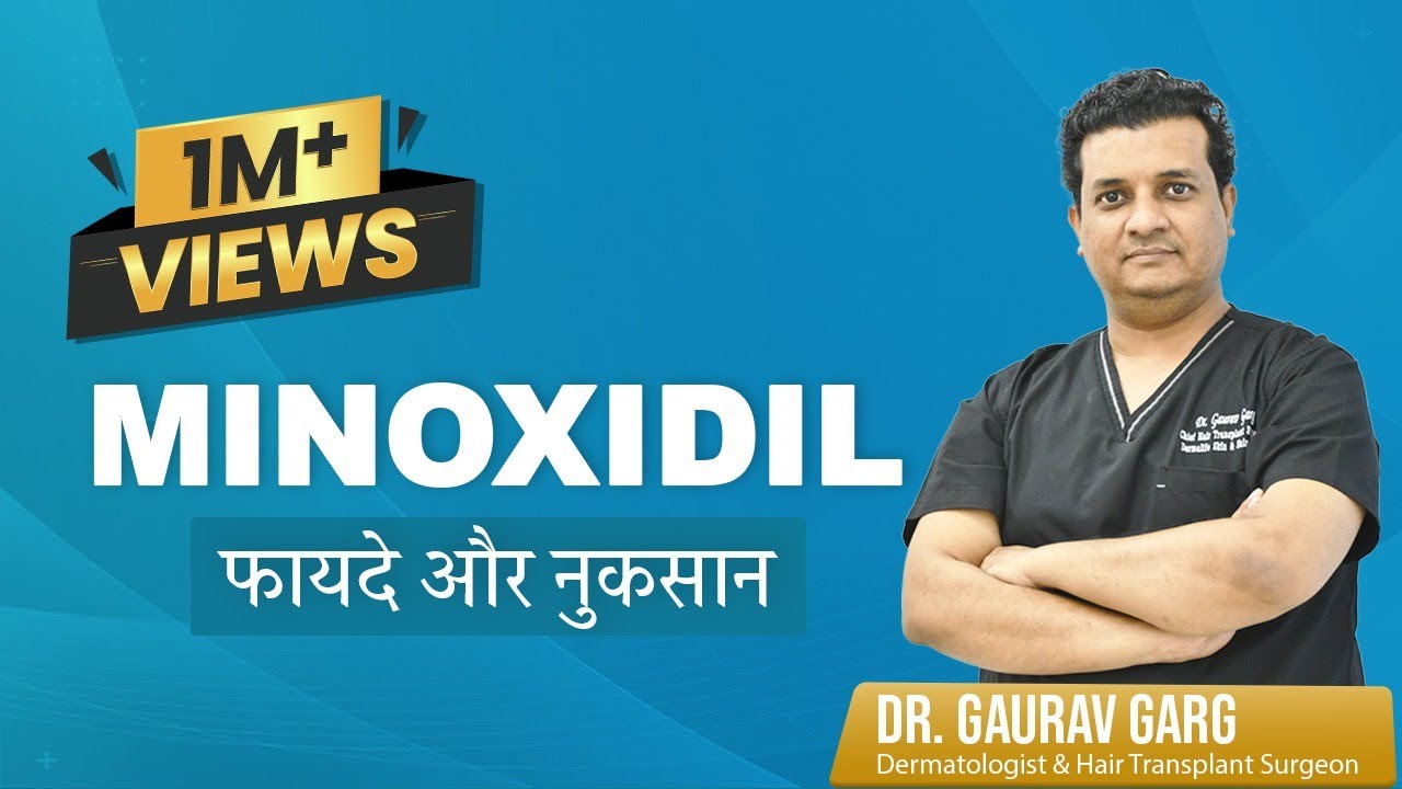 मिनोक्सिडिल: बाल उगाने की दवाई के फ़ायदे और नुक़सान | Minoxidil Hair Regrowth Results, Side Effects