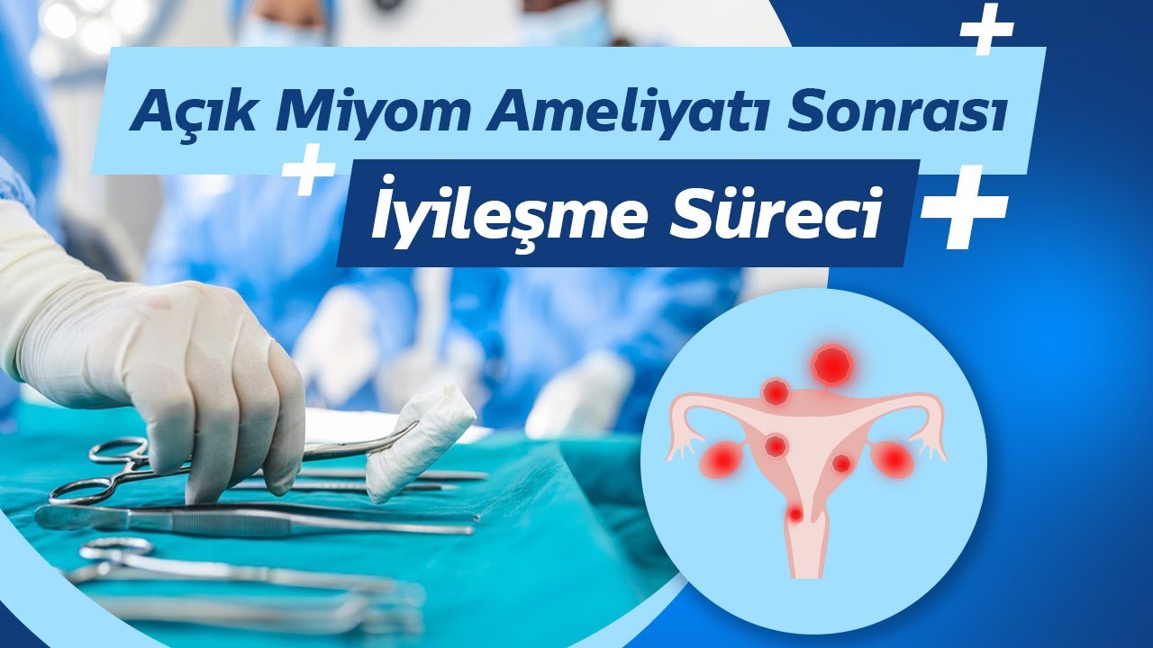 Açık Miyom Ameliyatı Sonrası İyileşme Süreci Açık Miyom Ameliyatı Sonrası Karında Şişlik Olur mu?