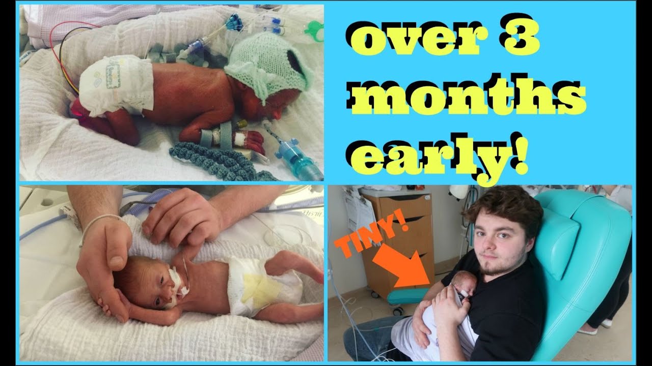 My Premature Baby | 26 weeks gestation