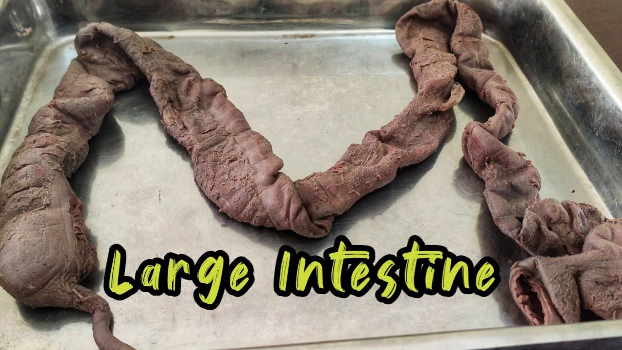 Large Intestine Anatomy | Bangla | Anatomy of The Large Intestine