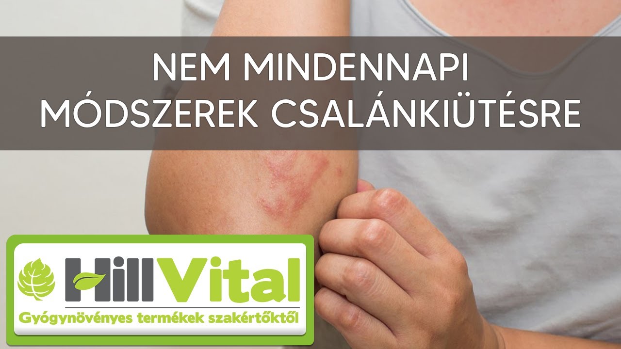 7 meglepő m&oacute;dszer csal&aacute;nki&uuml;t&eacute;s ellen - HillVital
