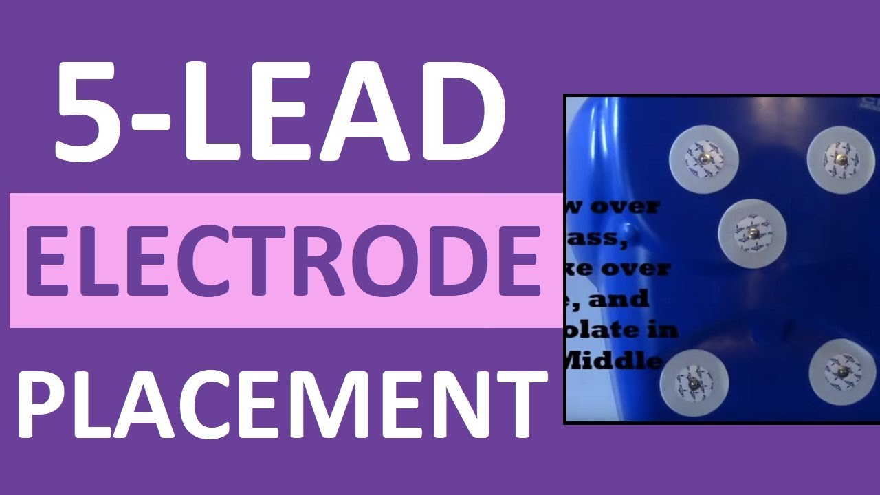 5 Lead Electrode Placement Cardiac Telemetry Monitor for EKG/ECG