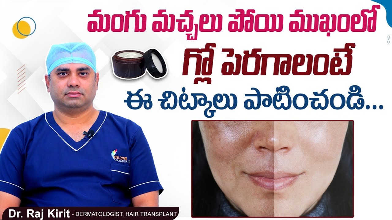 Best Skincare for Melasma in Telugu | Melasma Treatment | Dr Raj Kirit | Celestee Skin & Hair Clinic