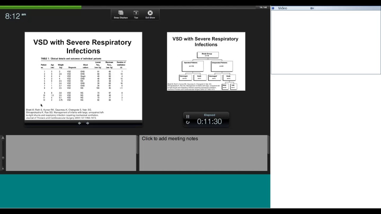 VSD management by Dr Krishna Kumar
