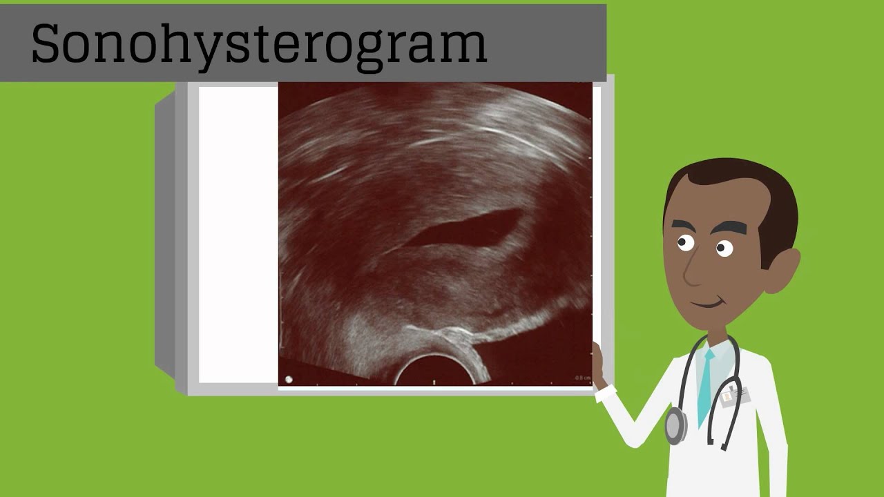 Topic 53: Uterine Leiomyoma