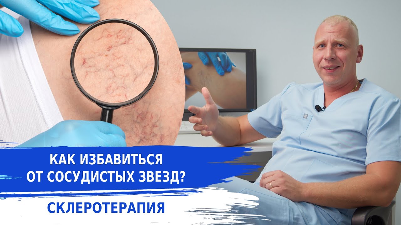 КАК УБРАТЬ СОСУДИСТУЮ СЕТКУ НА НОГАХ?