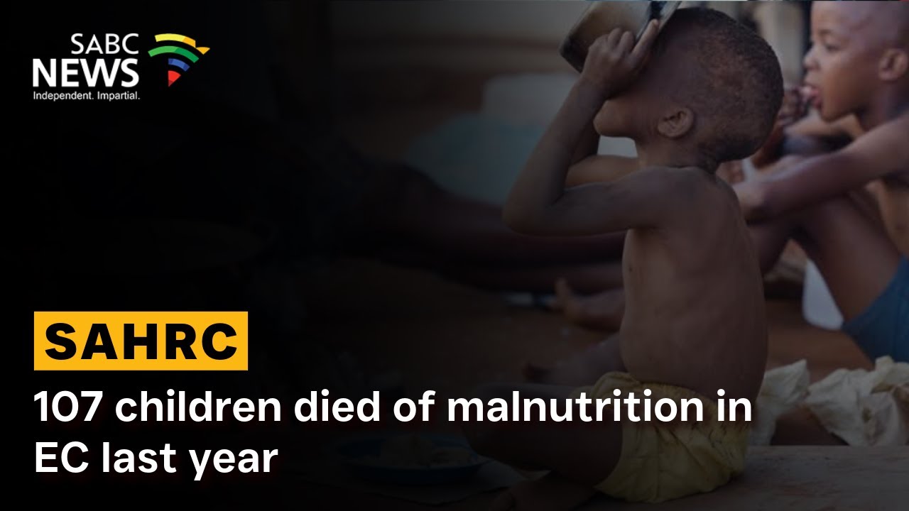 107 children died of malnutrition in EC last year: SAHRC