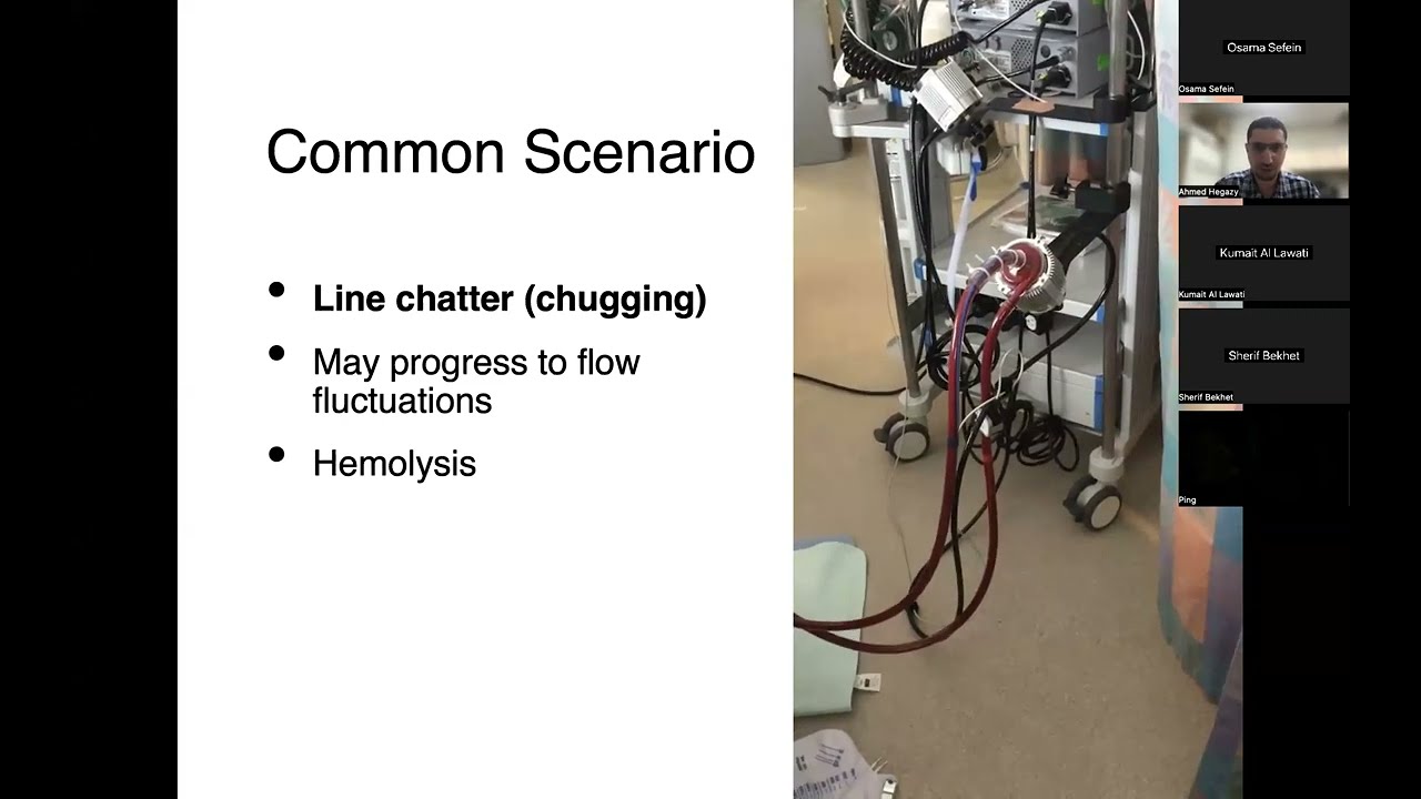 Troubleshooting VA ECMO in the Cardiac Surgery ICU
